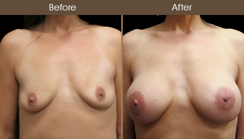 20202805154615_B78-front